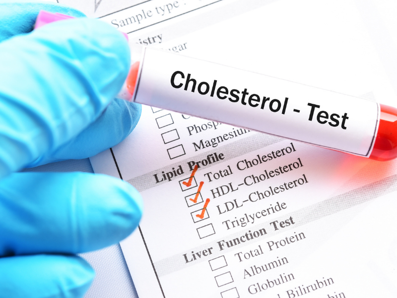 What Are The Preventive Health Checkup Tests That One Should Take